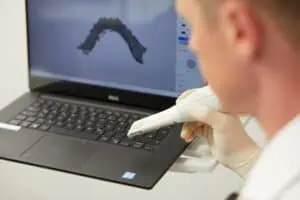 Eine Person mit Handschuhen hält einen Zahnscanner neben einem Laptop. Auf dem Bildschirm wird ein 3D-Modell von Zahnbögen angezeigt, das die Verfahren von Zahn Chriurgie in einem klinischen oder labortechnischen Scan- und Modellierungsprozess verdeutlicht.