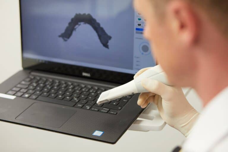 Eine Person mit Handschuhen hält einen Zahnscanner neben einem Laptop. Auf dem Bildschirm wird ein 3D-Modell von Zahnbögen angezeigt, das die Verfahren von Zahn Chriurgie in einem klinischen oder labortechnischen Scan- und Modellierungsprozess verdeutlicht.
