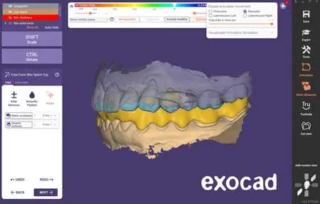 Ein Screenshot der exocad-Dental-Software zeigt ein digitales 3D-Modell der oberen und unteren Zähne in blauen, gelben und beigen Schichten vor einem violetten Hintergrund. Menüs und Werkzeuge sind auf der linken und rechten Seite des Bildschirms zu sehen. Das exocad-Logo befindet sich unten rechts.